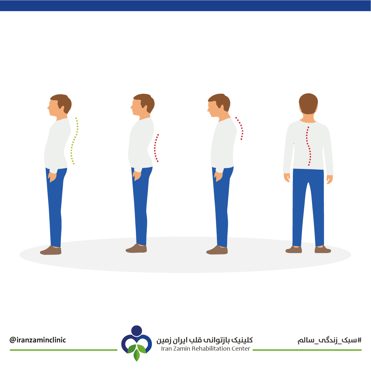 علاج تقوس أسفل الظهر (القعس) بالعلاج بالتمارين الرياضية